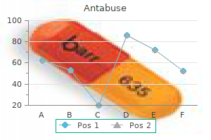 antabuse 500mg discount