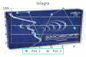 buy 50 mg silagra mastercard