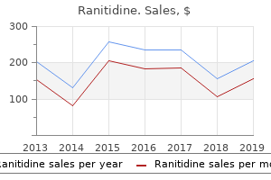 300 mg ranitidine overnight delivery