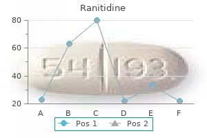 cheap ranitidine 300mg with mastercard