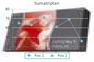 generic 25mg sumatriptan mastercard