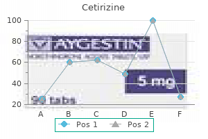 buy 5mg cetirizine otc