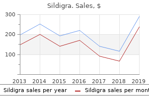 generic 120 mg sildigra amex