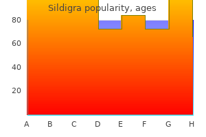 25mg sildigra fast delivery